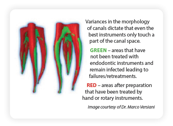 EndoUltra Variances In Morphology