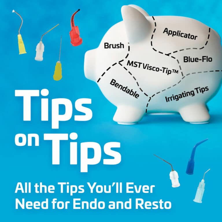 Tips On Tips – Vista Apex