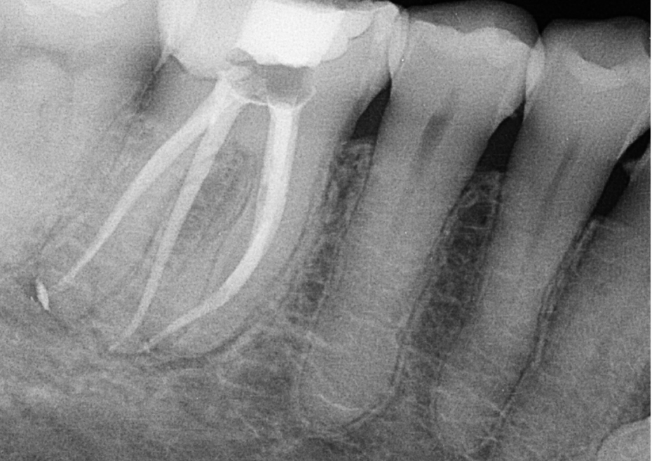 1080X1080_Cross #1 (2)