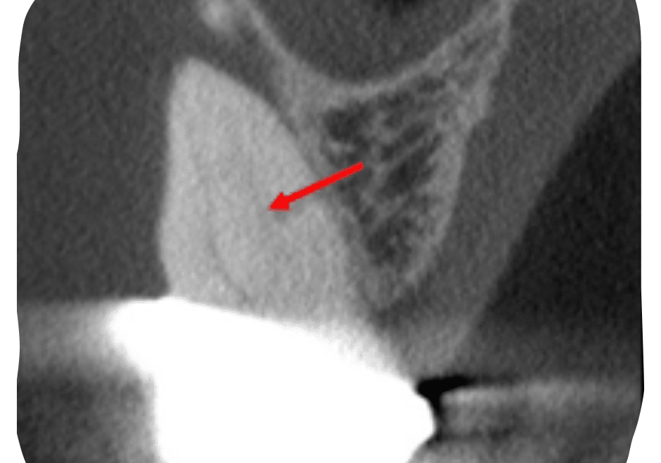 1080X1080_Kolnick Case #1 (1)