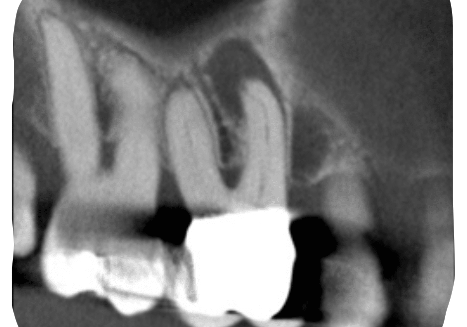 1080X1080_Kolnick Case #1 (2)