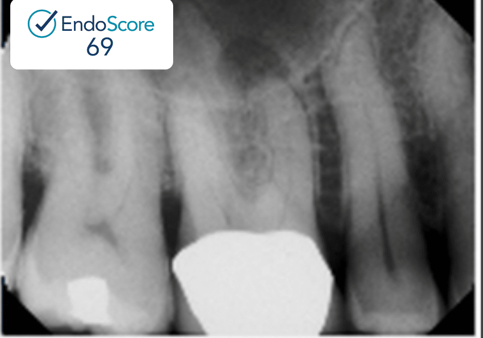 1080X1080_Kolnick Case #1